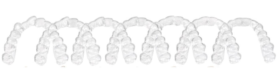 Clear orthodontic aligners arranged in a progressive sequence showing teeth straightening treatment stages.