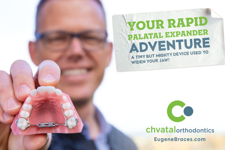 Male orthodontist holds pink palatal expander model, promoting rapid dental expansion treatment at Chvatal Orthodontics.