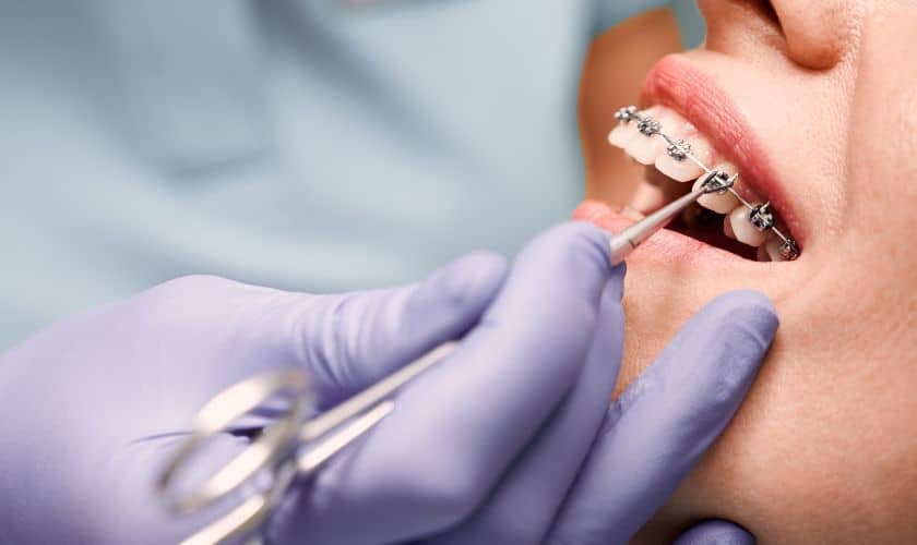 Orthodontist examining patient's teeth with braces during dental consultation.